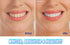 Dental Scaler Polishing Vibrating Dental Instrument - ROUTINE FASHION